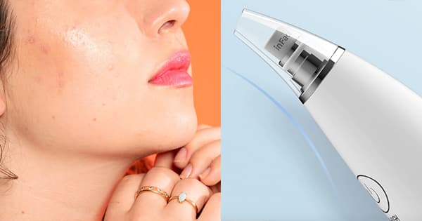 TOP 5 máy hút mụn mini hiệu quả, an toàn, được nhiều người tin dùng nhất Shopee